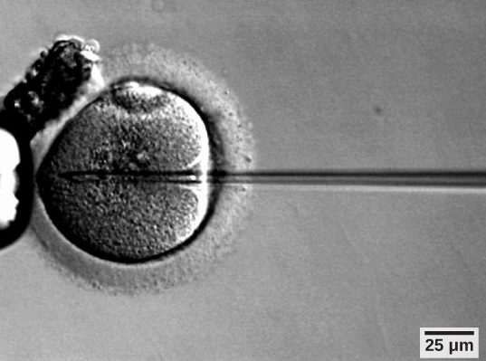 Micrograph shows a needle injecting sperm into an egg.