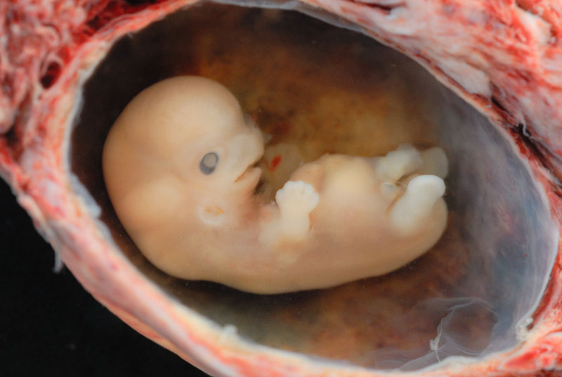 image of tiny embryo depicting some development of arms and legs, as well as facial features starting to show.