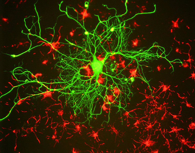 Cortical neuron stained with antibody to neurofilament subunit NF-L in green. In red are neuronal stem cells stained with antibody to alpha-internexin. Image created using antibodies from EnCor Biotechnology Inc.