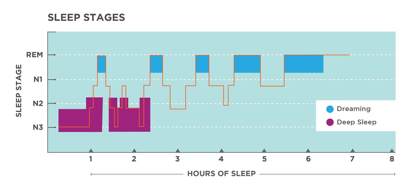 This is a hypnogram showing the transitions of the sleep cycle during a typical seven hour period of sleep. During the first hour, the person goes through stages 1,2, and 3. In the second hour, sleep oscillates between Stages 2 and 3 before attaining a 30-minute period of REM sleep. The third hour follows the same pattern as the second, but ends with a brief awake period. The fourth hour follows a similar pattern as the third, with a slightly longer REM stage. In the fifth hour, stage 3 is no longer reached. The sleep stages are fluctuating from 2, to 1, to REM, to awake, and then they repeat with shortening intervals until the end of the seventh hour when the person awakens.