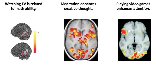 3 different images. The first is the brain activation fMRI showing activity in the brain, the other shows an overhead fMRI of activation and a statement that says 