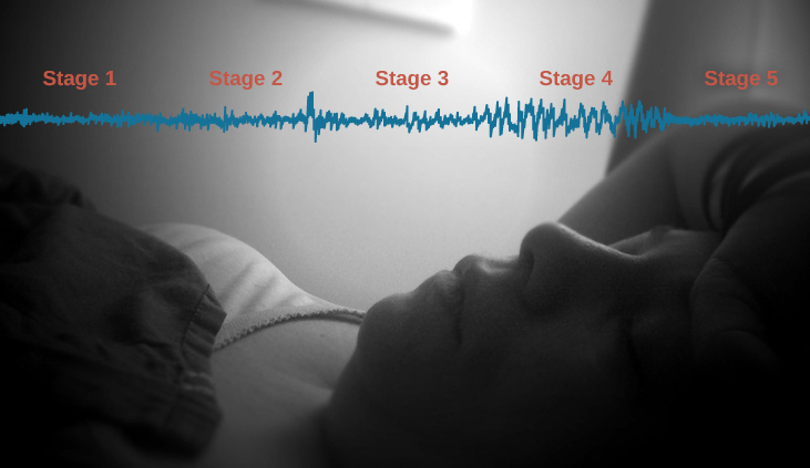 A photograph shows a person sleeping.  Superimposed across the top of the picture is a line representing brainwave activity across the five stages of sleep. Above the line, from left to right, it reads stage 1, stage 2, stage 3, stage 4, and stage 5. The wave amplitude is highest in late stage 2, and near the end of stage 3 through stage 4. The wavelength I longer from late stage 2 through stage 4.